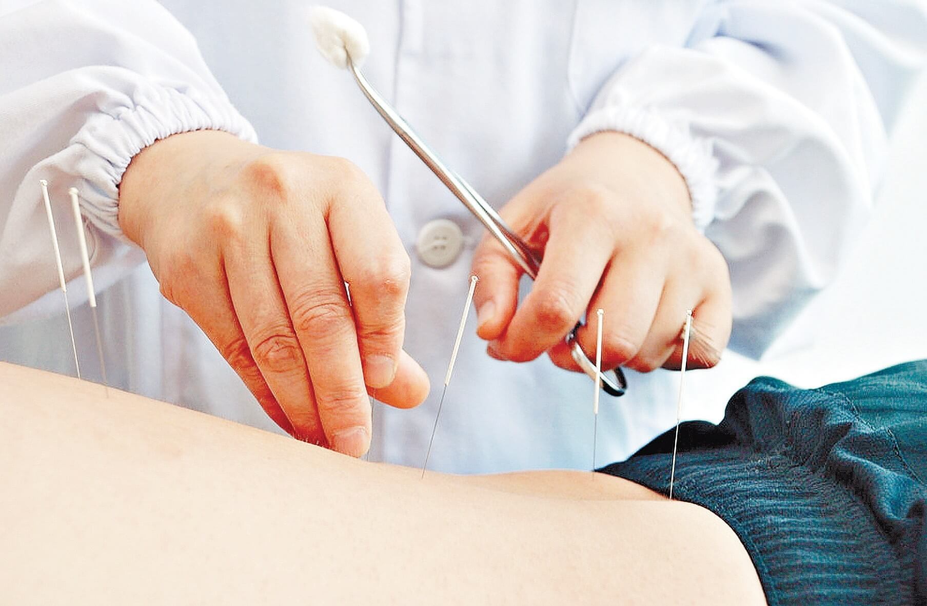 أفضل مركز للعلاج بالابر الصينية في دبي 7 مراكز رائعة ننصحك بها البوابة